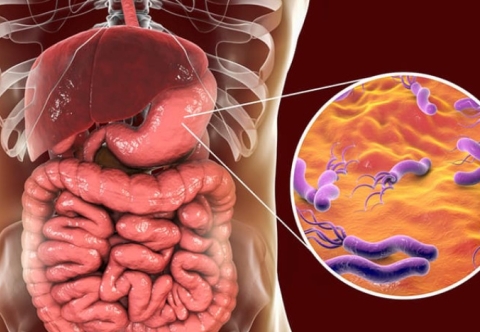 Nguyên nhân chính gây ra viêm dạ dày